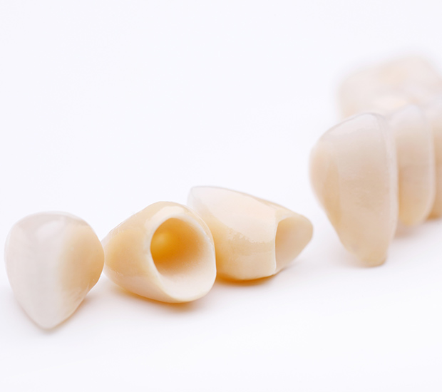 Santa Rosa Dental Crowns and Dental Bridges