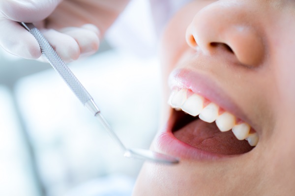 How A Dental Sealant Can Keep Teeth Clean