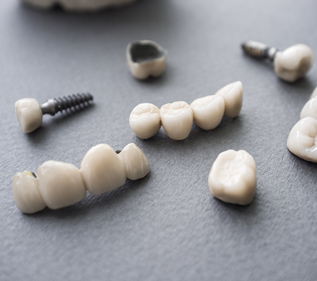 Santa Rosa The Difference Between Dental Implants and Mini Dental Implants