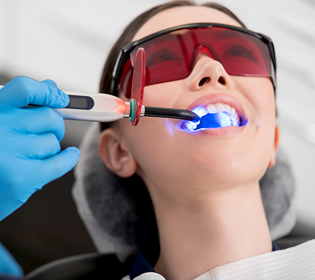 Santa Rosa Professional Teeth Whitening