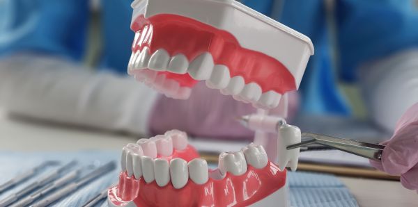 How To Choose Between Tooth Extraction And Root Canal